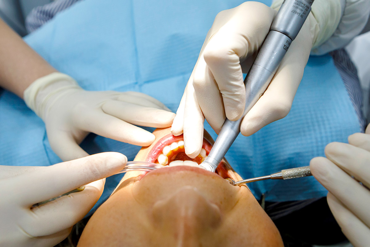 Mejores implantes dentales Madrid